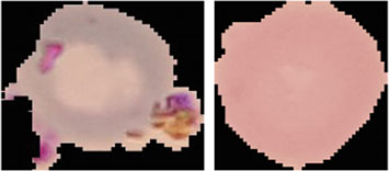 Uninfected and Infected cells